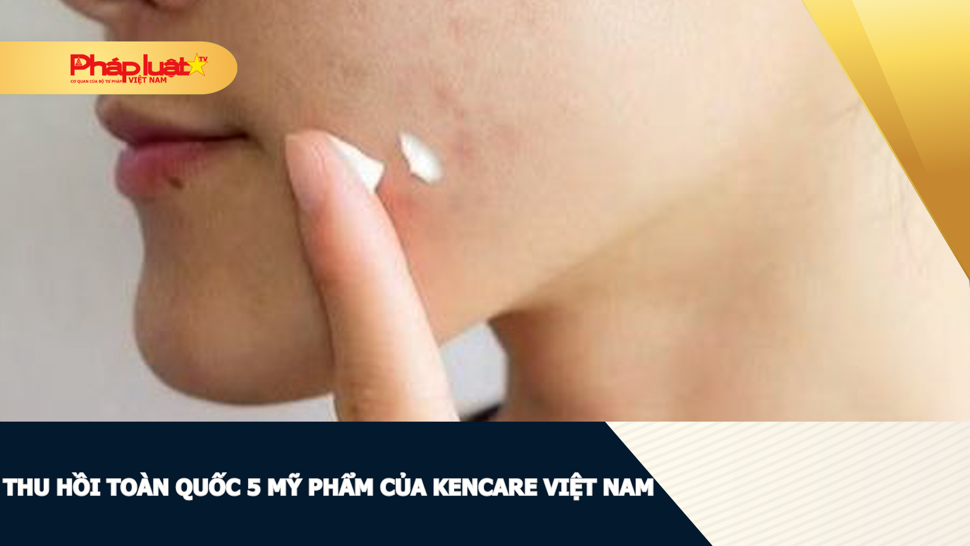 Thu hồi toàn quốc 5 mỹ phẩm của Kencare Việt Nam