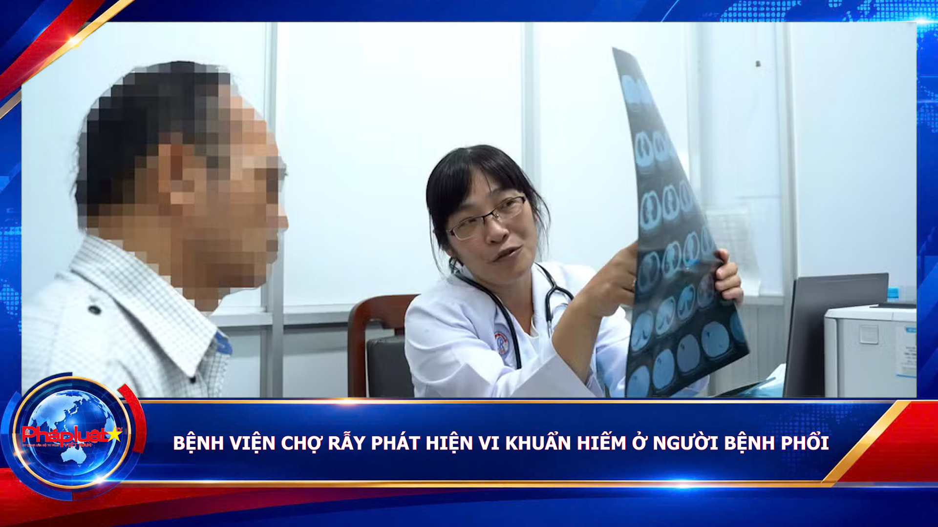 Bệnh viện Chợ Rẫy phát hiện vi khuẩn hiếm ở người bệnh phổi