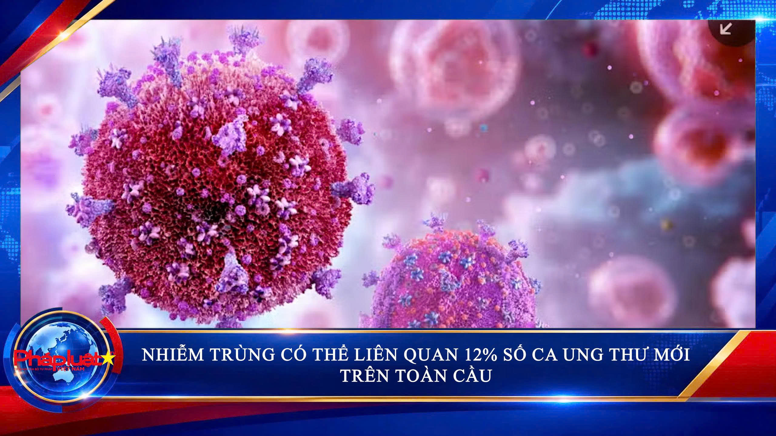  Nhiễm trùng có thể liên quan 12% số ca ung thư mới trên toàn cầu